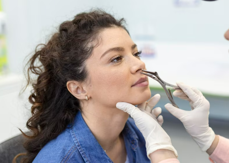 CHIRURGIE DU NEZ OU DES SINUS